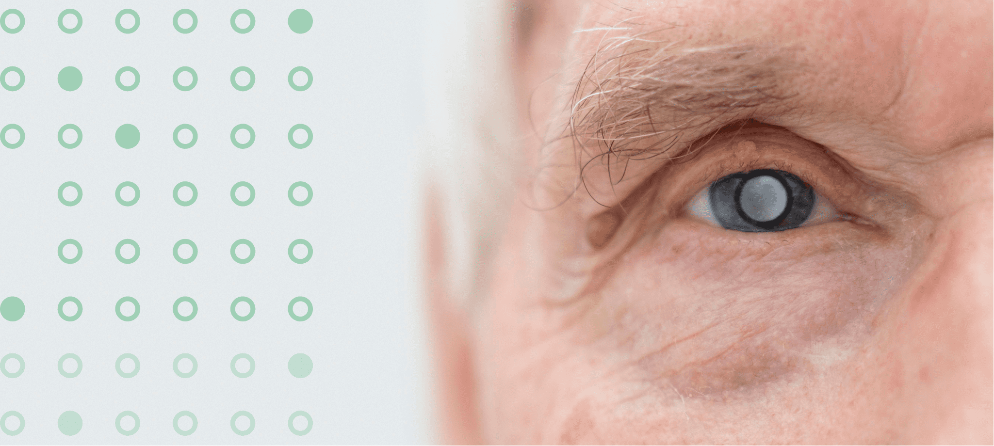 Как лечить начальную катаракту?